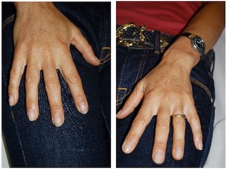 rejuvenation of hands