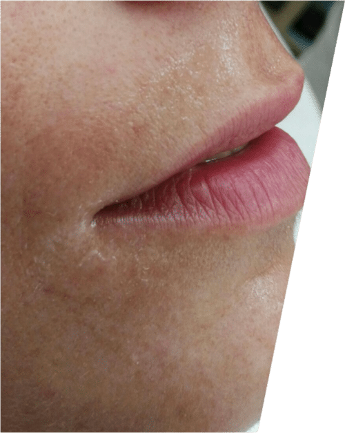 prima