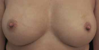 Dopo 1