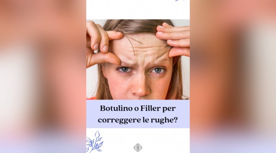 botulino o filler per correggere le rughe