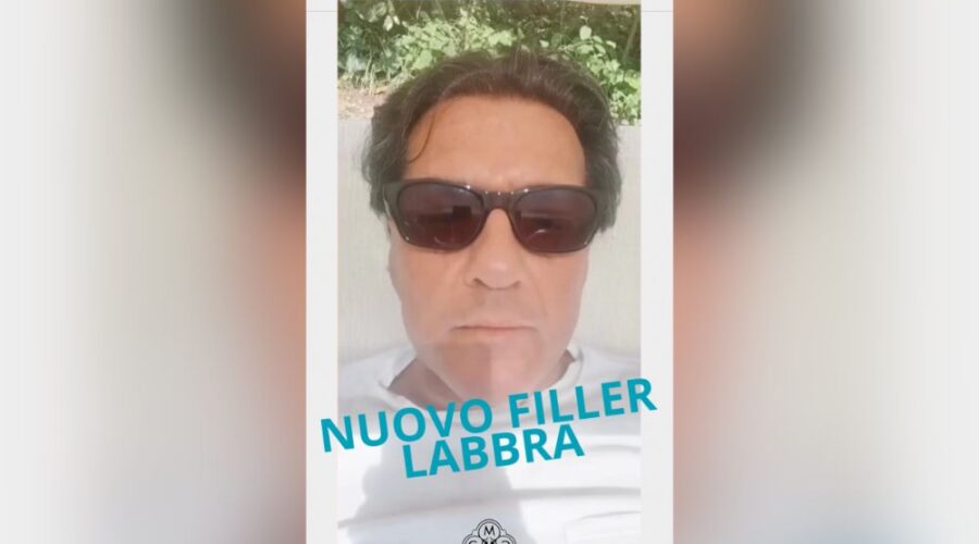 nuovo filler per labbra molto naturali