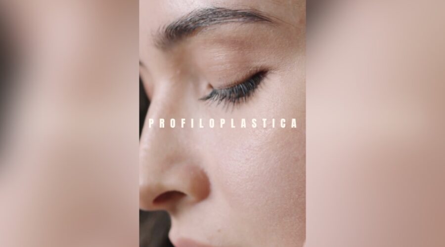 profiloplastica facciale