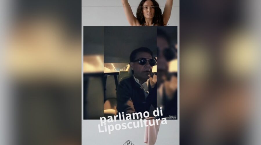 parliamo di liposcultura