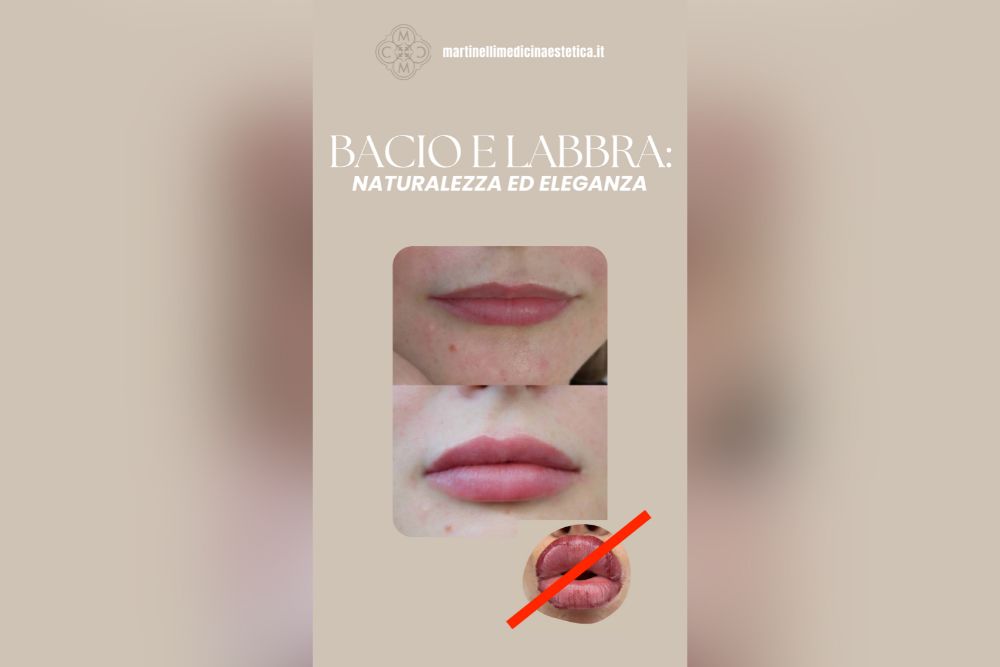 no russian lips