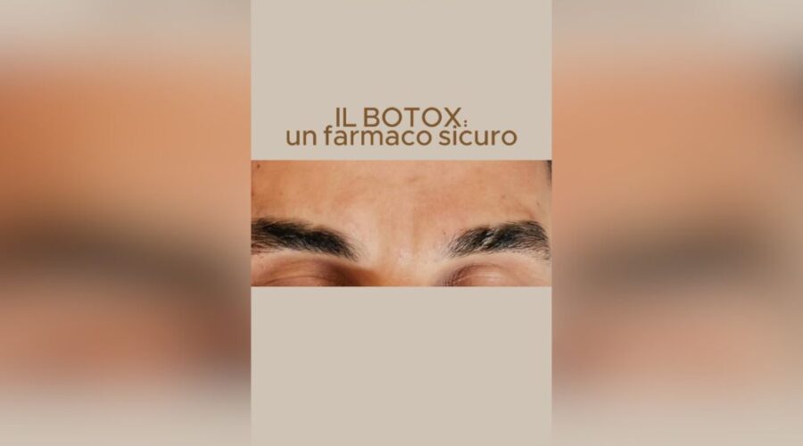 Botox Farmaco sicuro per attenuare segni d'espressione