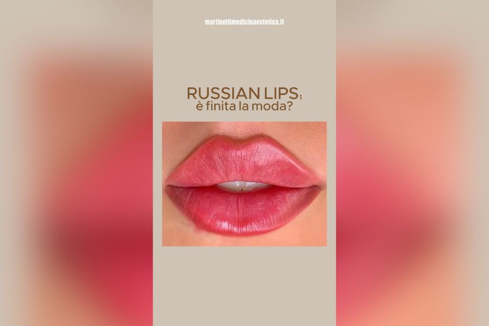 Russian lips è finita la moda