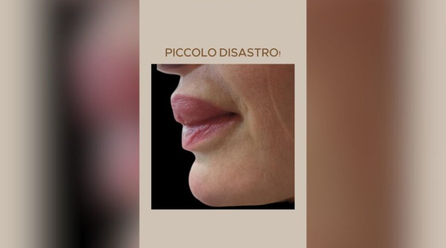 Rimedio a un piccolo disastro estetico