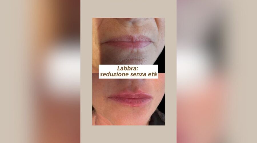 Labbra over 60? Perché no?