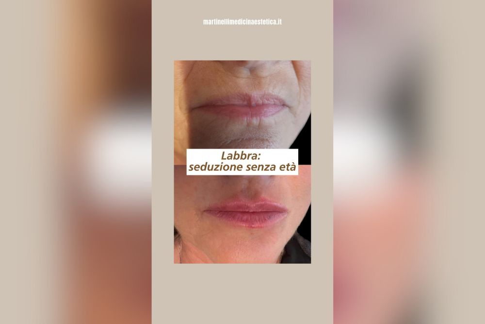 Labbra over 60? Perché no?