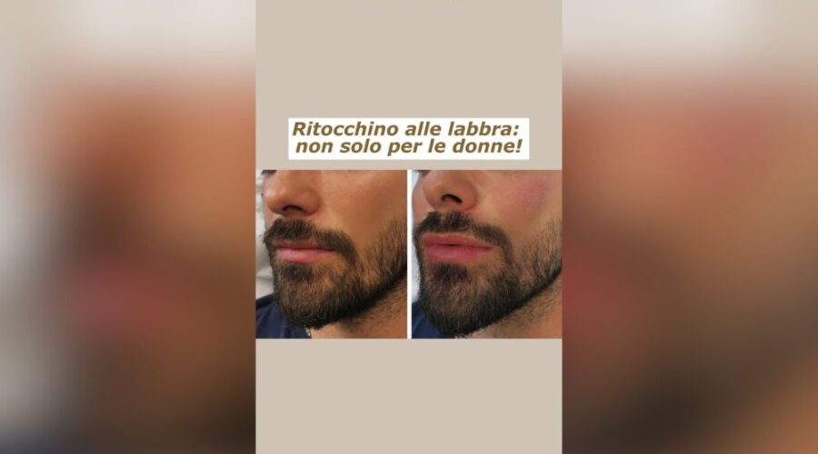 Bellezza al maschile ecco labbra ridefinite