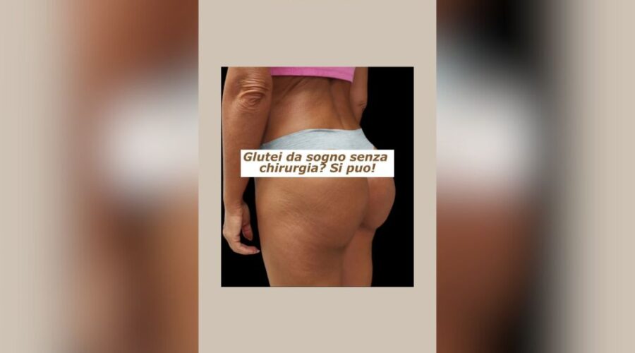 Glutei da sogno senza chirurgia? Si può!