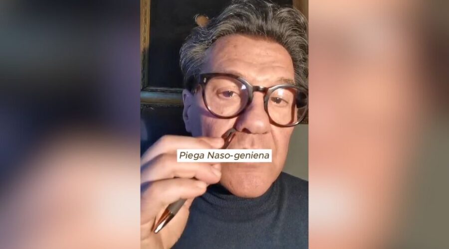 La piega naso-geniena come trattarla al meglio