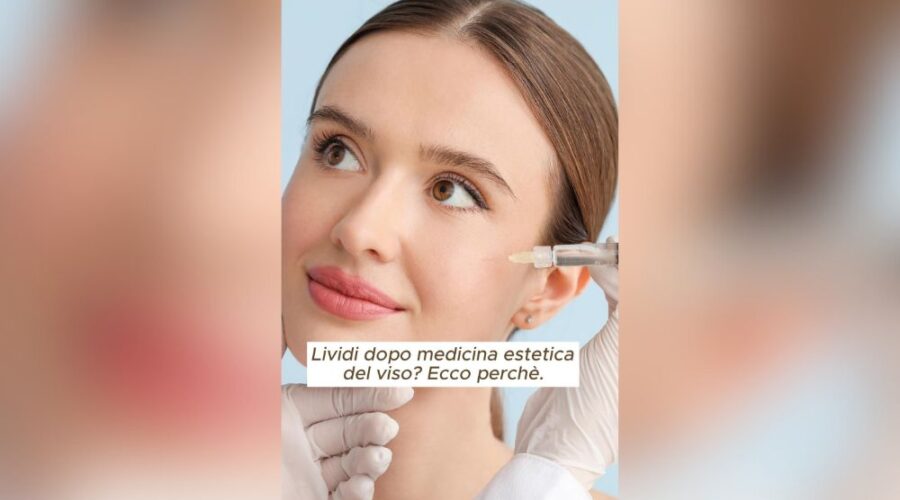 Lividi dopo un trattamento Facciamo chiarezza