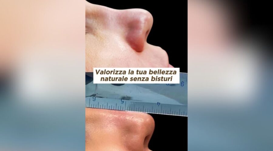 La Bellezza Oltre il Bisturi Scopri i Trattamenti Non Invasivi