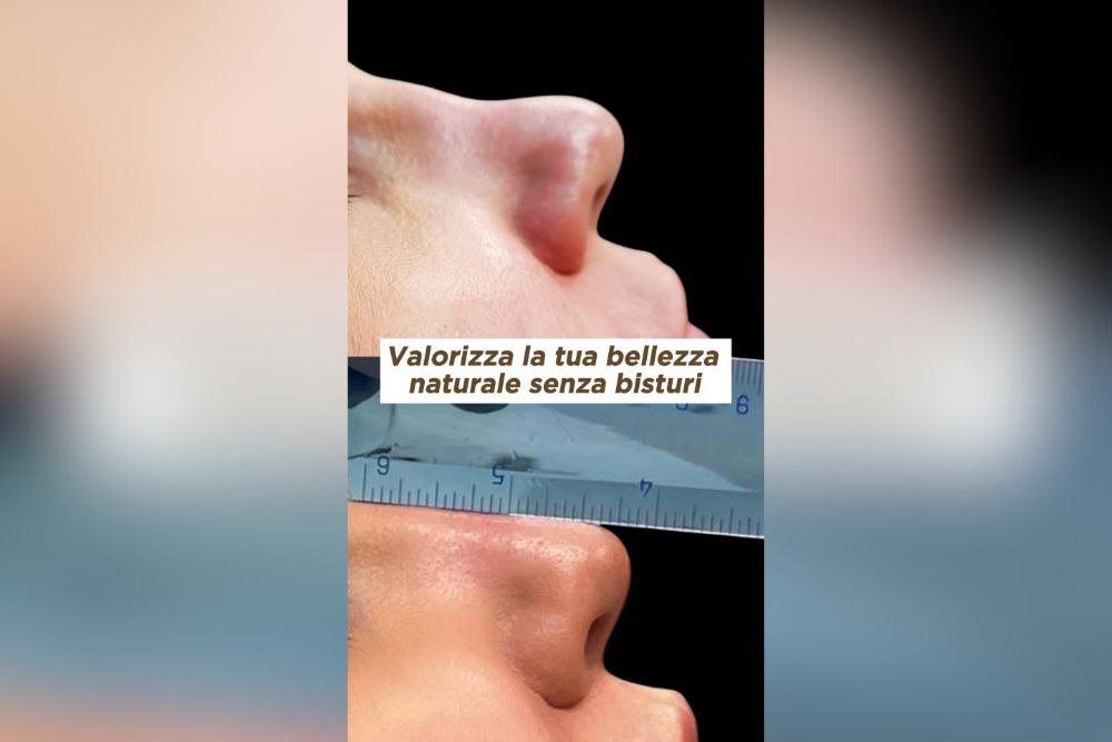 La Bellezza Oltre il Bisturi Scopri i Trattamenti Non Invasivi