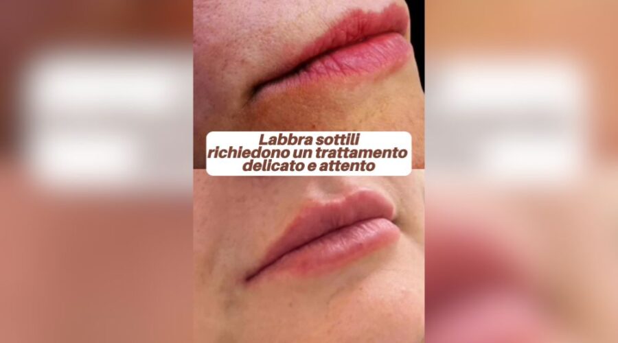 Hai le labbra sottil