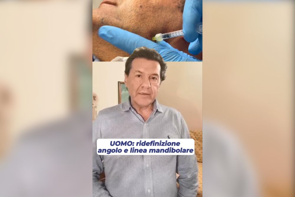 Mandibola scolpita senza chirurgia il segreto della mascolinizzazione del volto